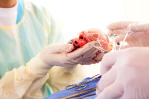 Read more about the article Es pot trasplantar qualsevol òrgan